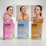 Acne & Pimple Patches 36 Pieces