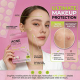 Acne & Pimple Patches 36 Pieces