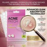 Acne & Pimple Patches 36 Pieces