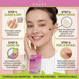 Acne & Pimple Patches 36 Pieces