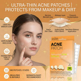 Acne & Pimple Patches 160 Pieces